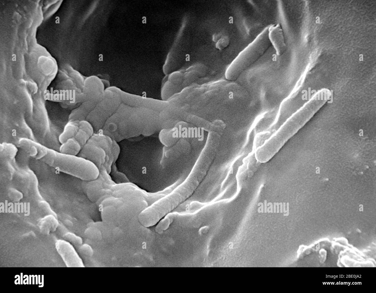 Balayage du micrographe Elctron (SEM) de Pseudomonas aeruginosa, une bactérie polyvalente à Gram négatif qui pousse dans le sol, les marais et les habitats marins côtiers, ainsi que dans les tissus végétaux et animaux. Pseudomonas aeruginosa est une bactérie en forme de tige qui peut causer des maladies chez les plantes et les animaux, y compris chez les humains. Espèce d'une importance médicale considérable, P. aeruginosa est un pathogène multirésistant reconnu pour son ubiquité, ses mécanismes de résistance aux antibiotiques à la pointe de la technologie, et son association avec des maladies graves, des infections acquises à l'hôpital comme le pneumonon associé au ventilateur Banque D'Images