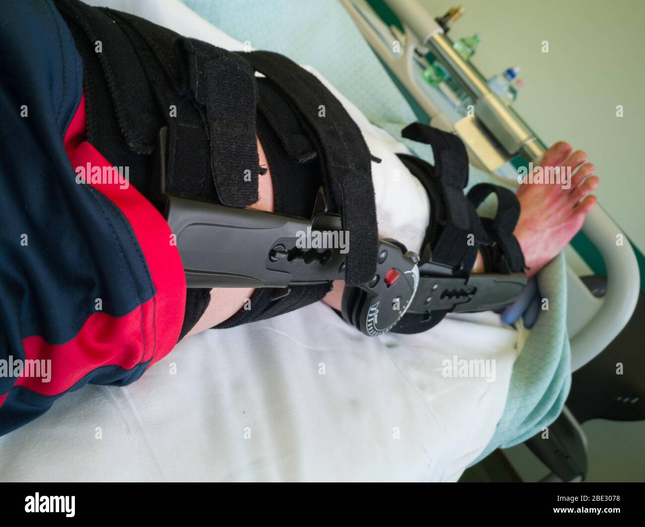 Jambe humaine avec patchs et Brace orthopédique après chirurgie du ligament du Cruciate antérieur : au lit à l'hôpital. Banque D'Images