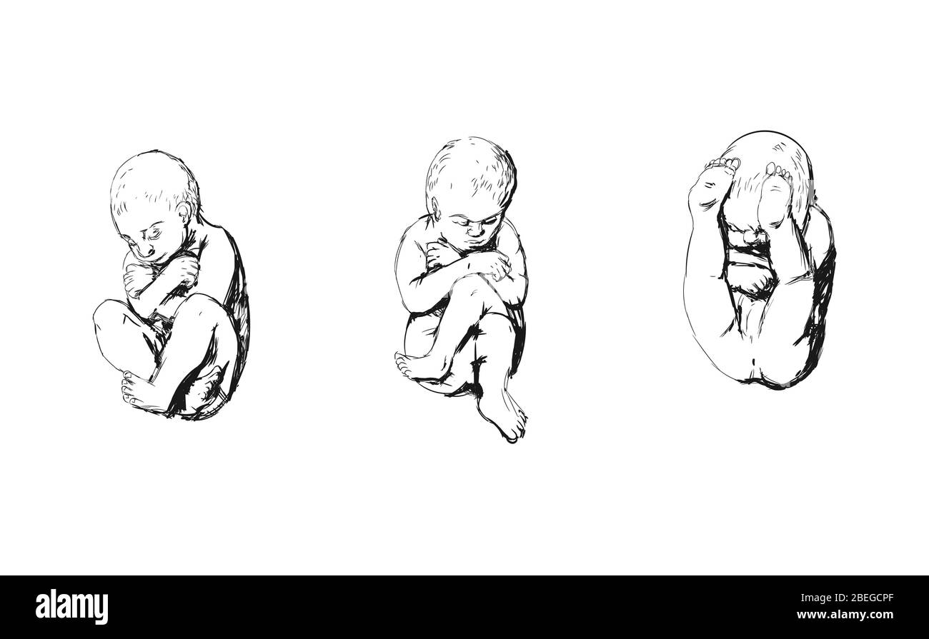 Positions de naissance de la culasse, illustration Banque D'Images