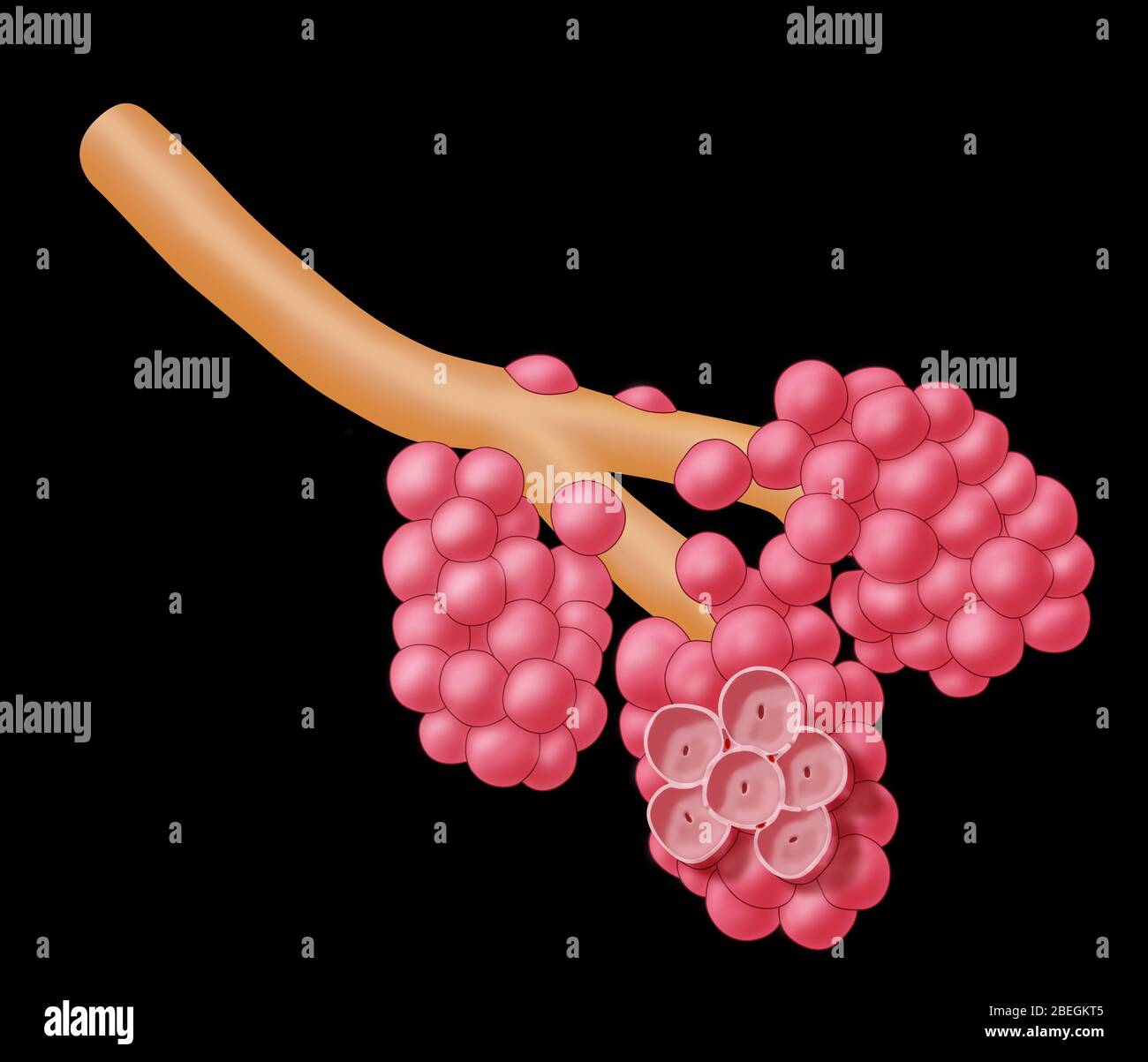 Alveoli endommagé par l'emphysème Banque D'Images