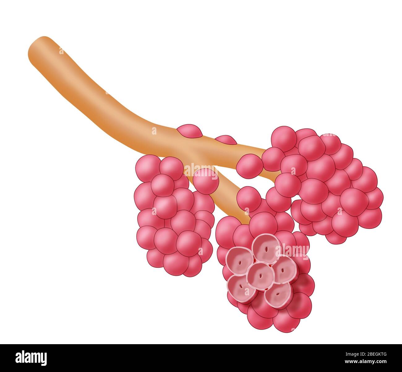 Alveoli endommagé par l'emphysème Banque D'Images