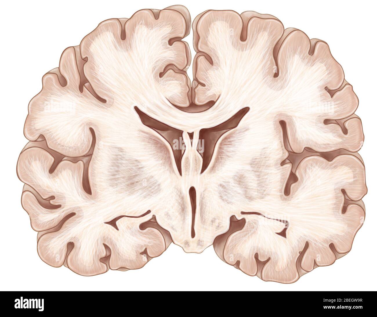 Cerveau, section coronale Banque D'Images