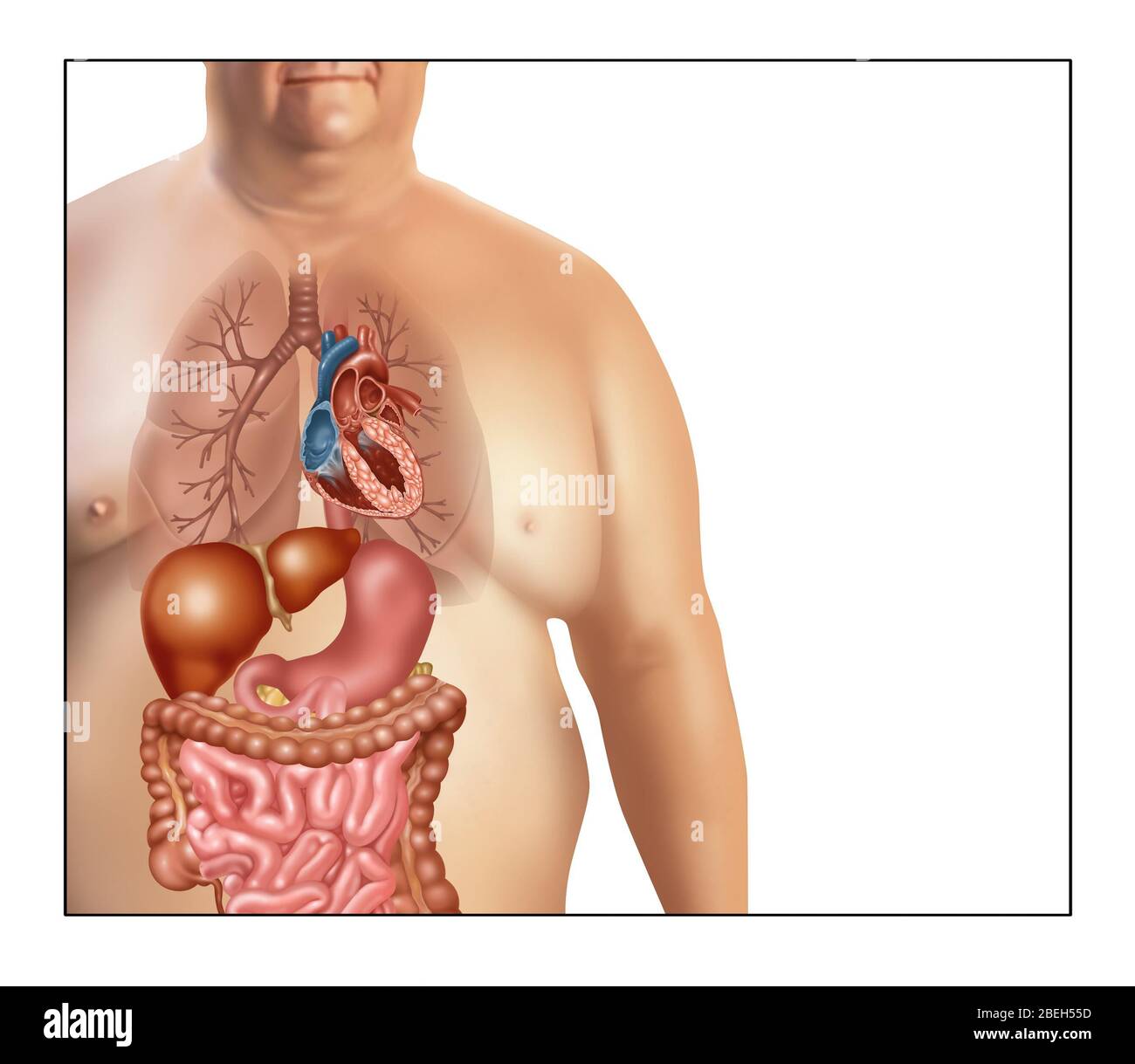 Dangers de l'obésité, illustration Banque D'Images