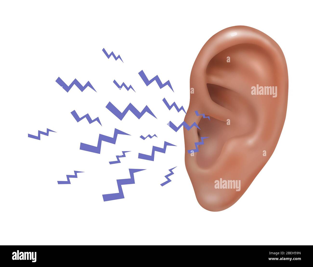 Bruit entrant dans l'oreille externe humaine, illustration Photo Stock -  Alamy