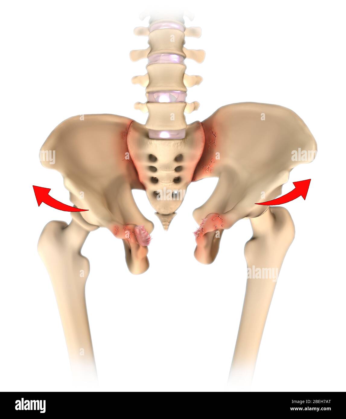 Ouvrir le livre fracture pelvienne Banque D'Images