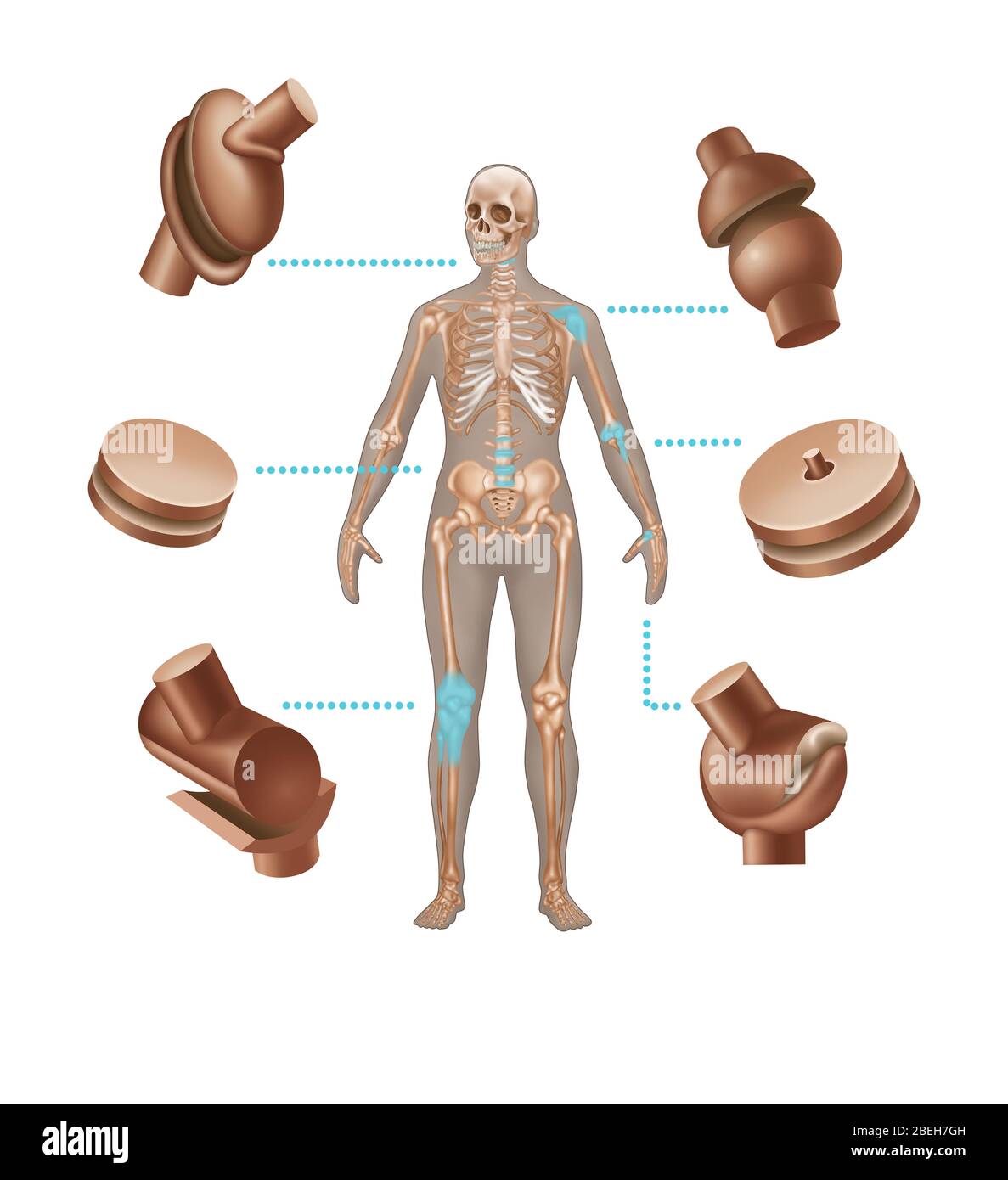 Remplacements de joints humains, illustration Banque D'Images