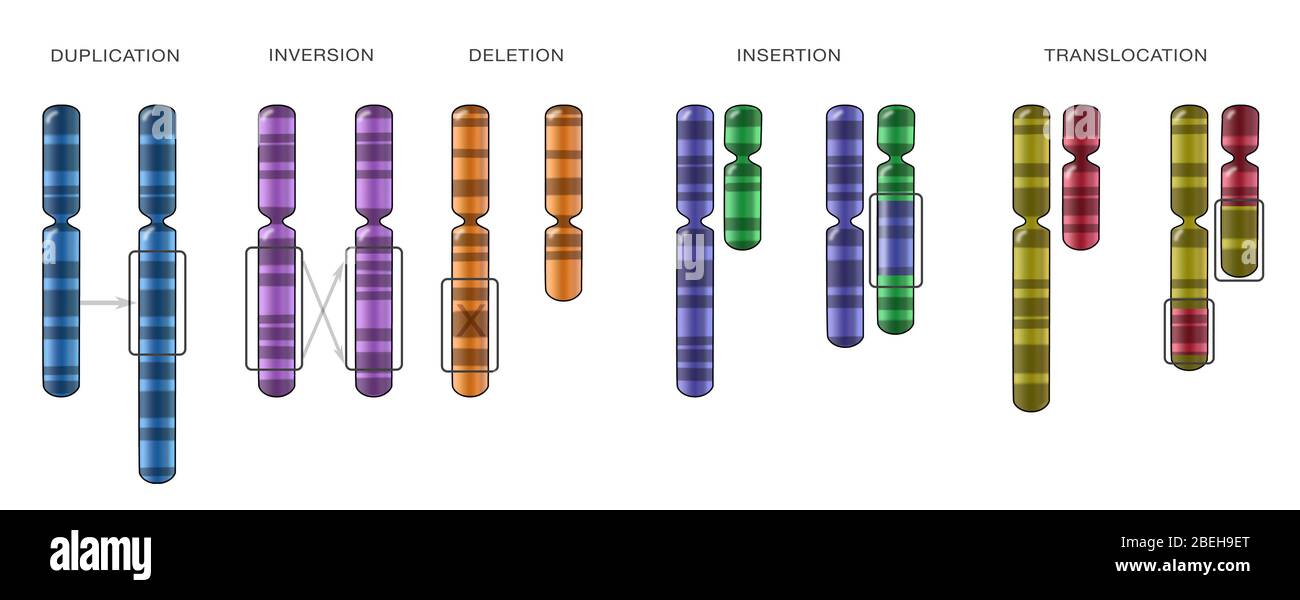 Anomalies chromosomiques, Illustration Banque D'Images