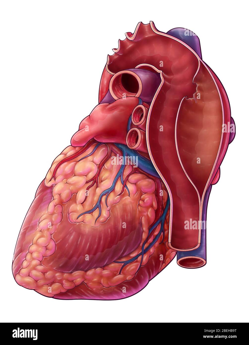 Dissection aortique, illustration Banque D'Images