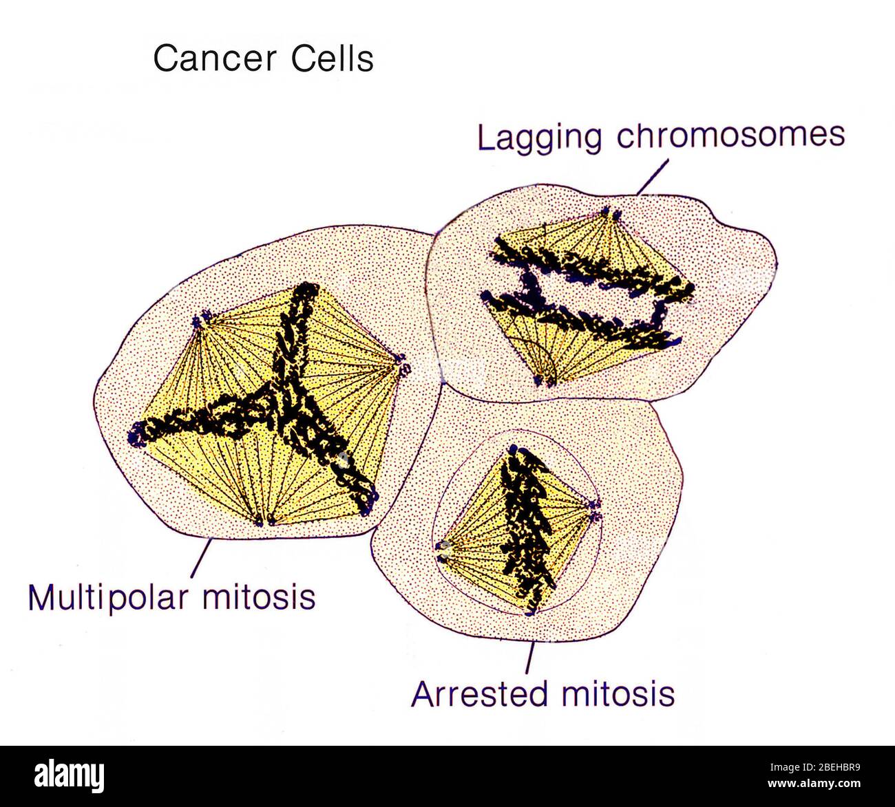 Cellules cancéreuses, illustration Banque D'Images