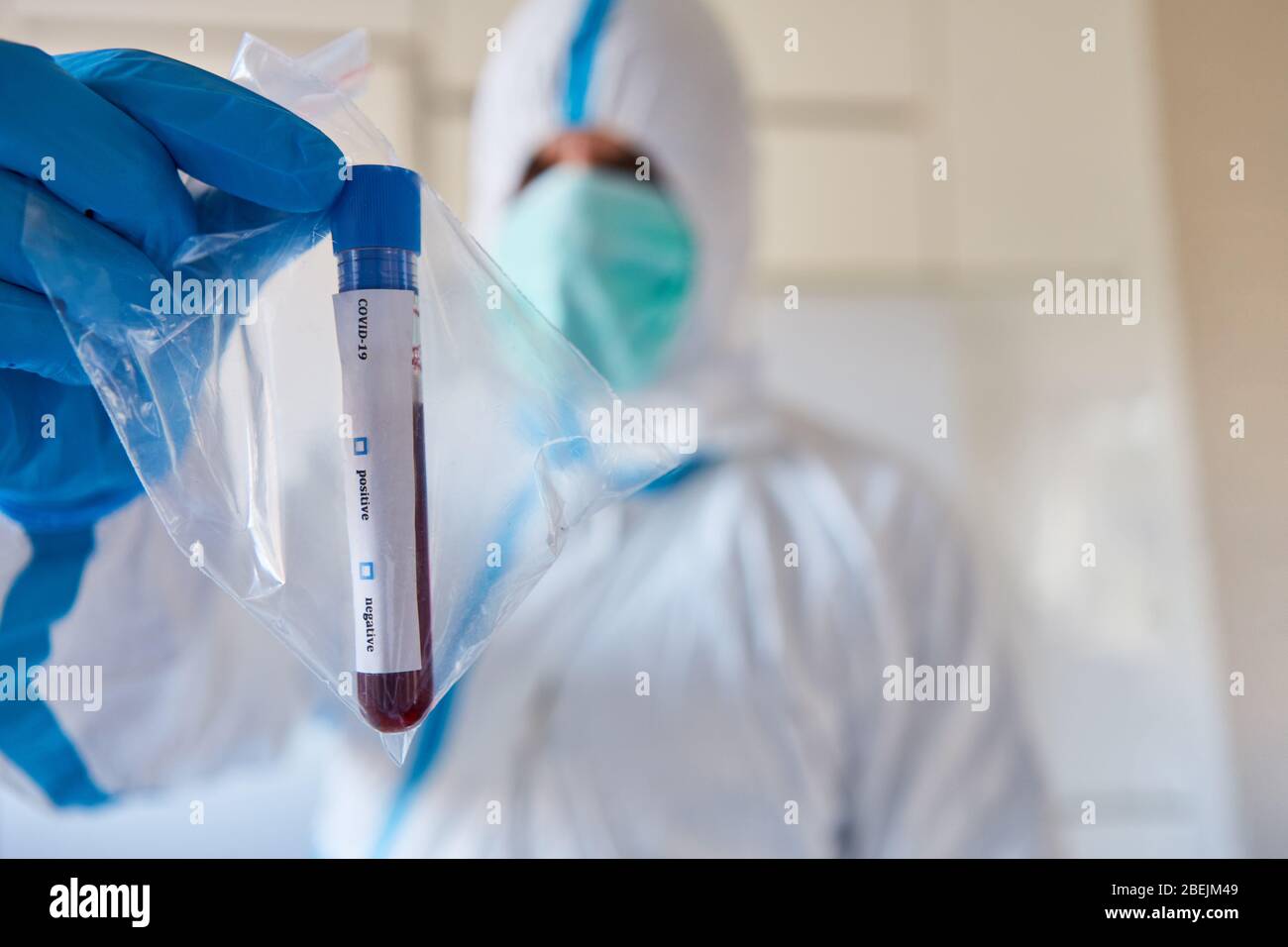 Medic dans des vêtements de protection avec échantillon sanguin pour test Covid-19 pour anticorps en laboratoire Banque D'Images