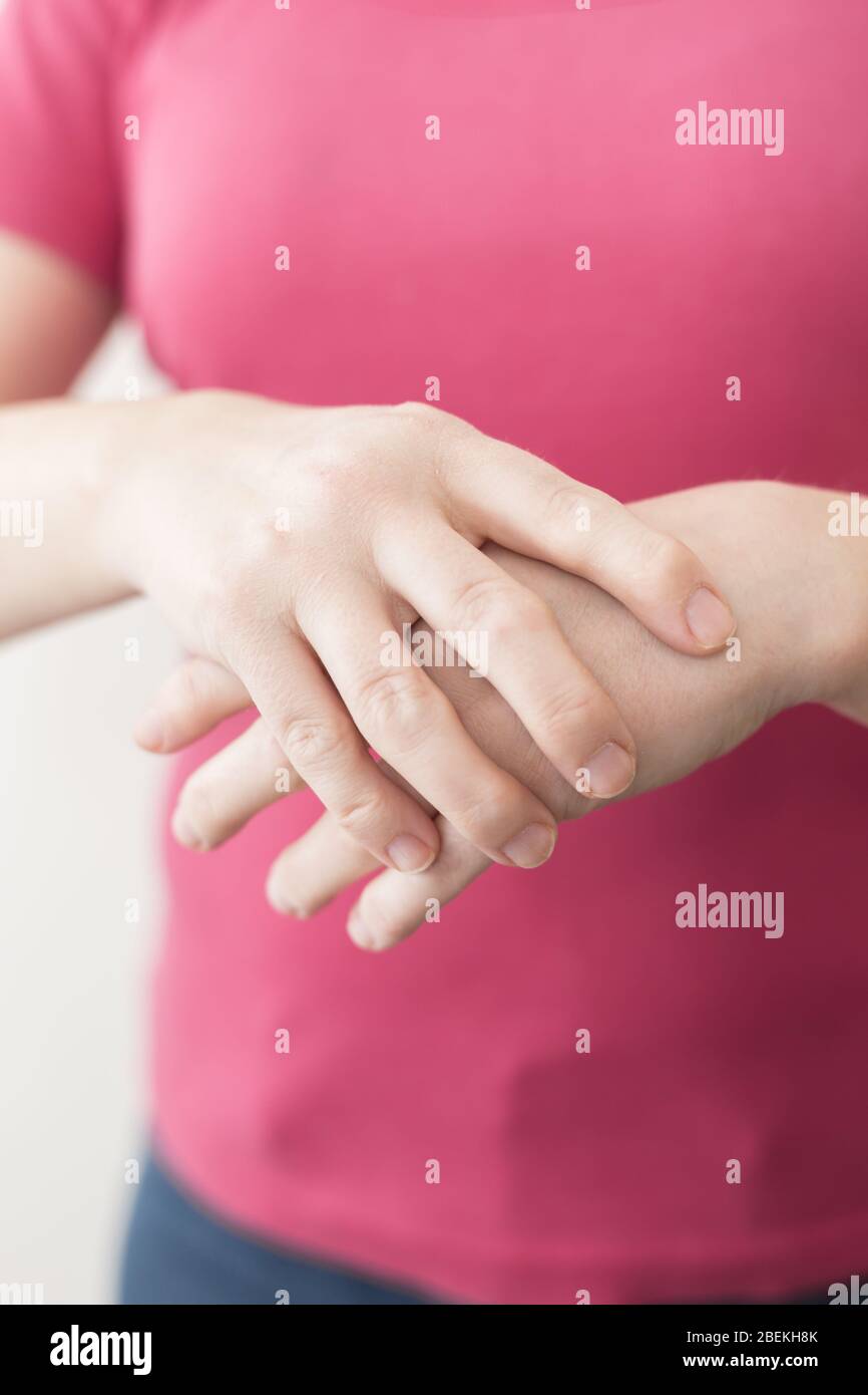 Jeune femme caucasienne ou fille blanche souffrant de douleur en main. Concept de soins de santé avec la polyarthrite rhumatoïde réelle déformée des doigts et des mains Banque D'Images