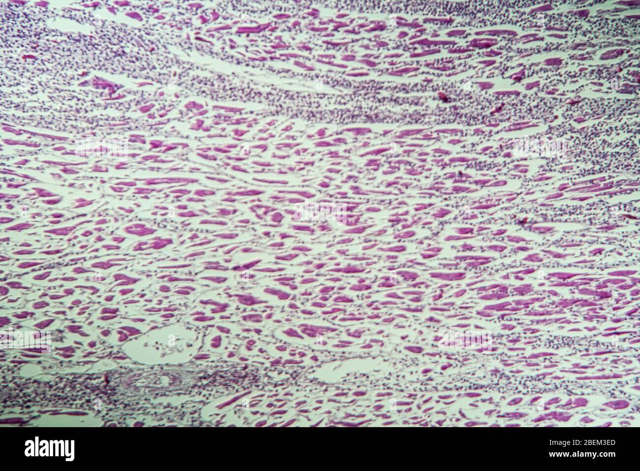 muscle cardiaque gonflé comme myocarde 100 fois Banque D'Images