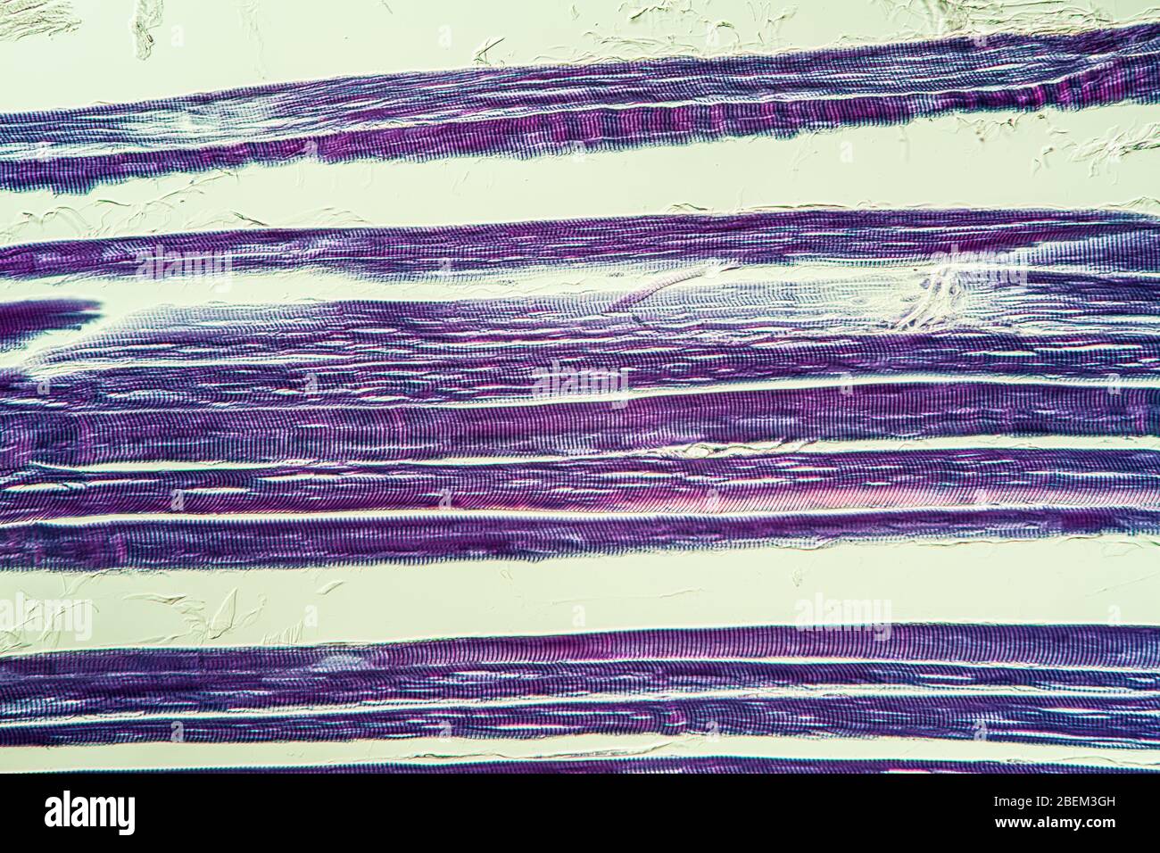 tissu musculaire strié sous le microscope 200 x. Banque D'Images