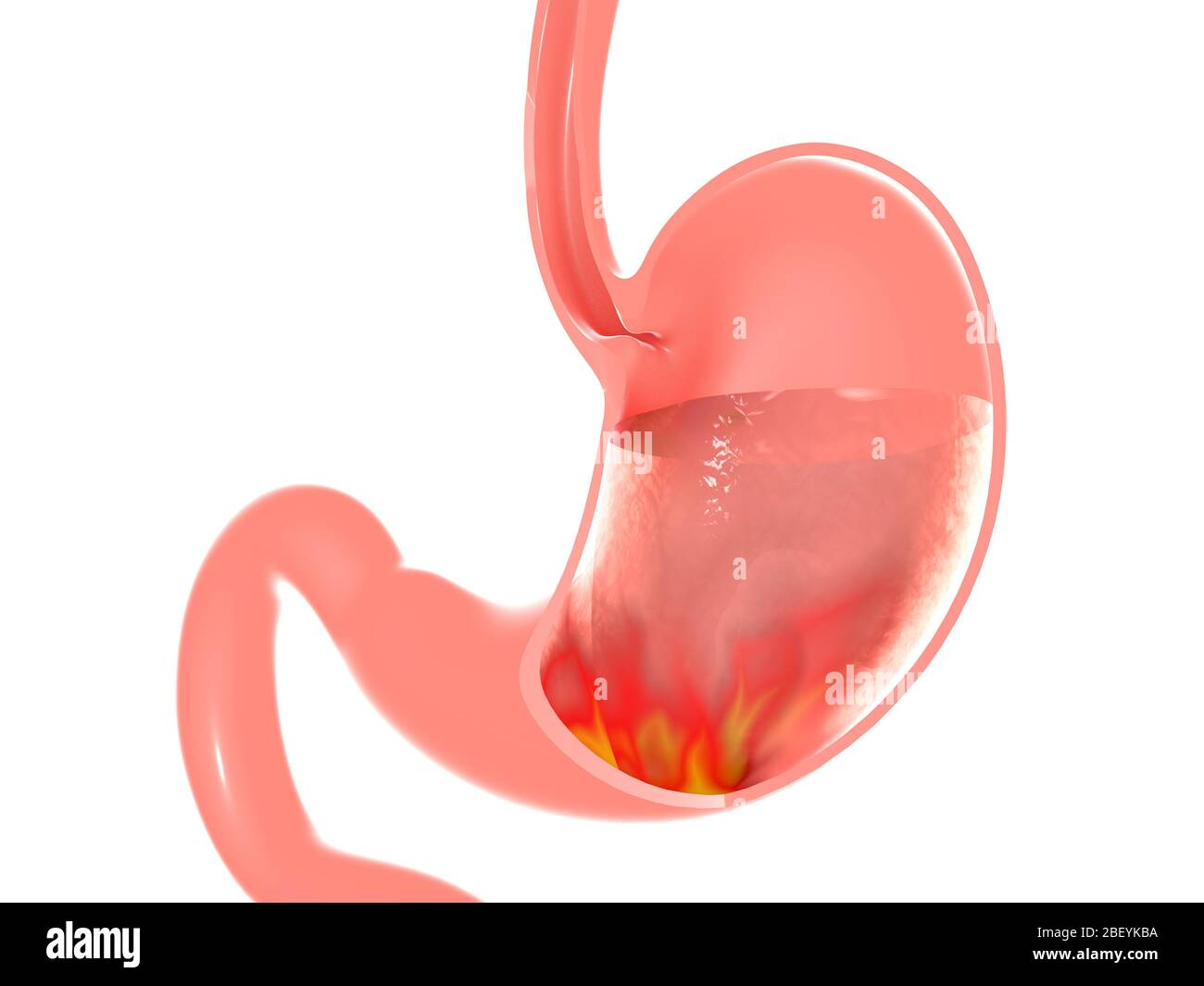 Illustration tridimensionnelle de l'estomac avec brûlures d'estomac et brûlures d'estomac. Section creuse de l'anatomie interne avec fluide montrant le feu interne. Banque D'Images