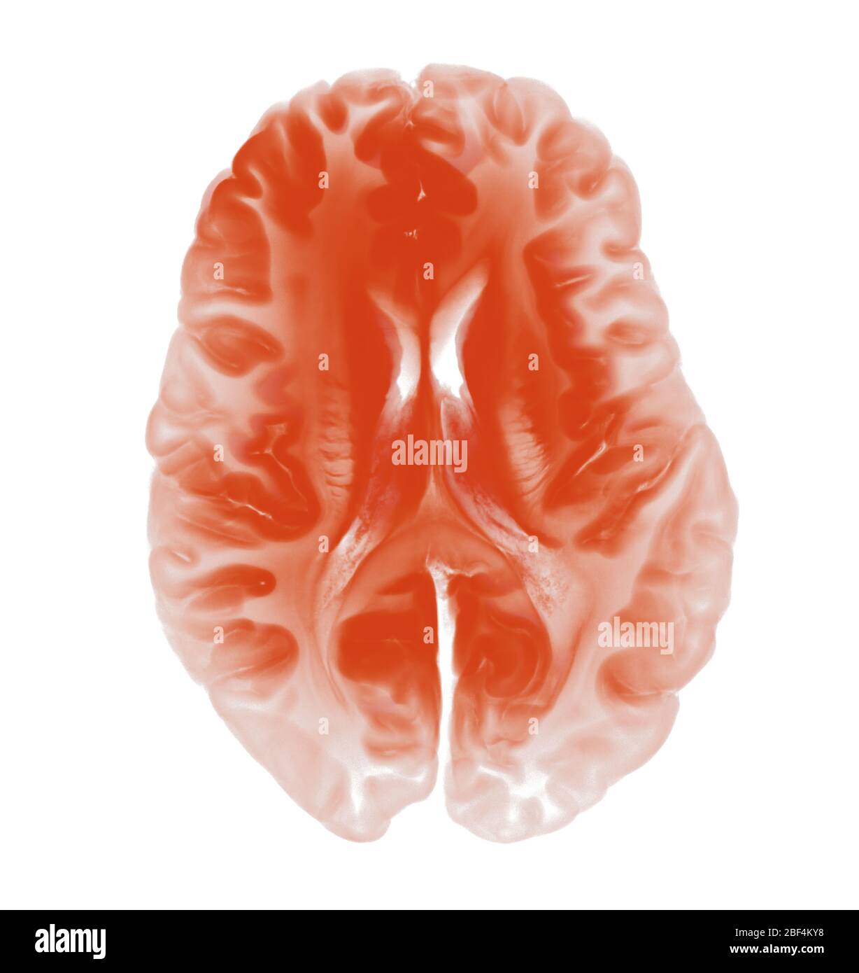 Vue de dessus coupe de cerveau isolée sur fond blanc. Concept pour les maladies neurologiques, les tumeurs et la chirurgie cérébrale Banque D'Images