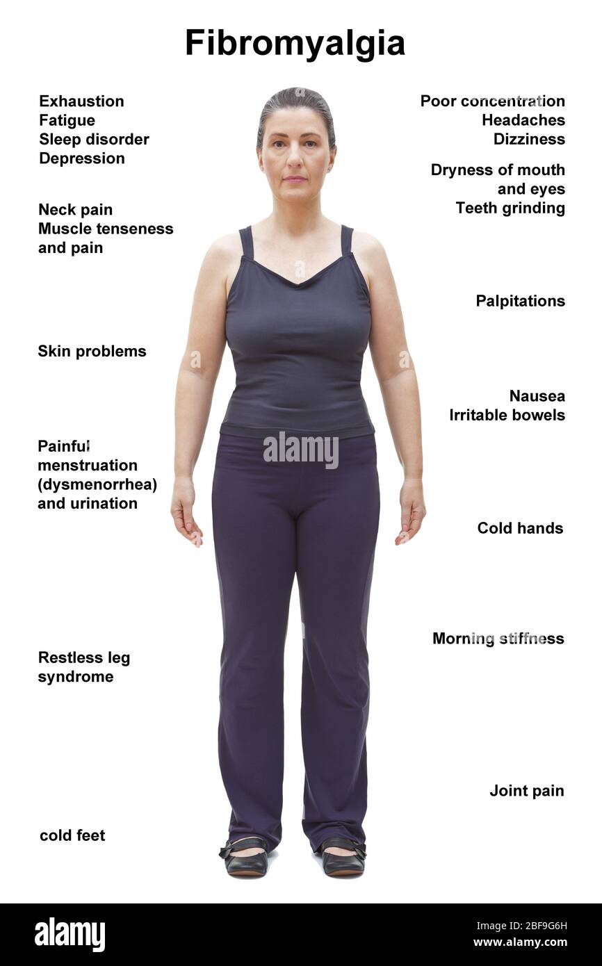 Fibromyalgie : corps féminin présentant les symptômes les plus courants. Banque D'Images