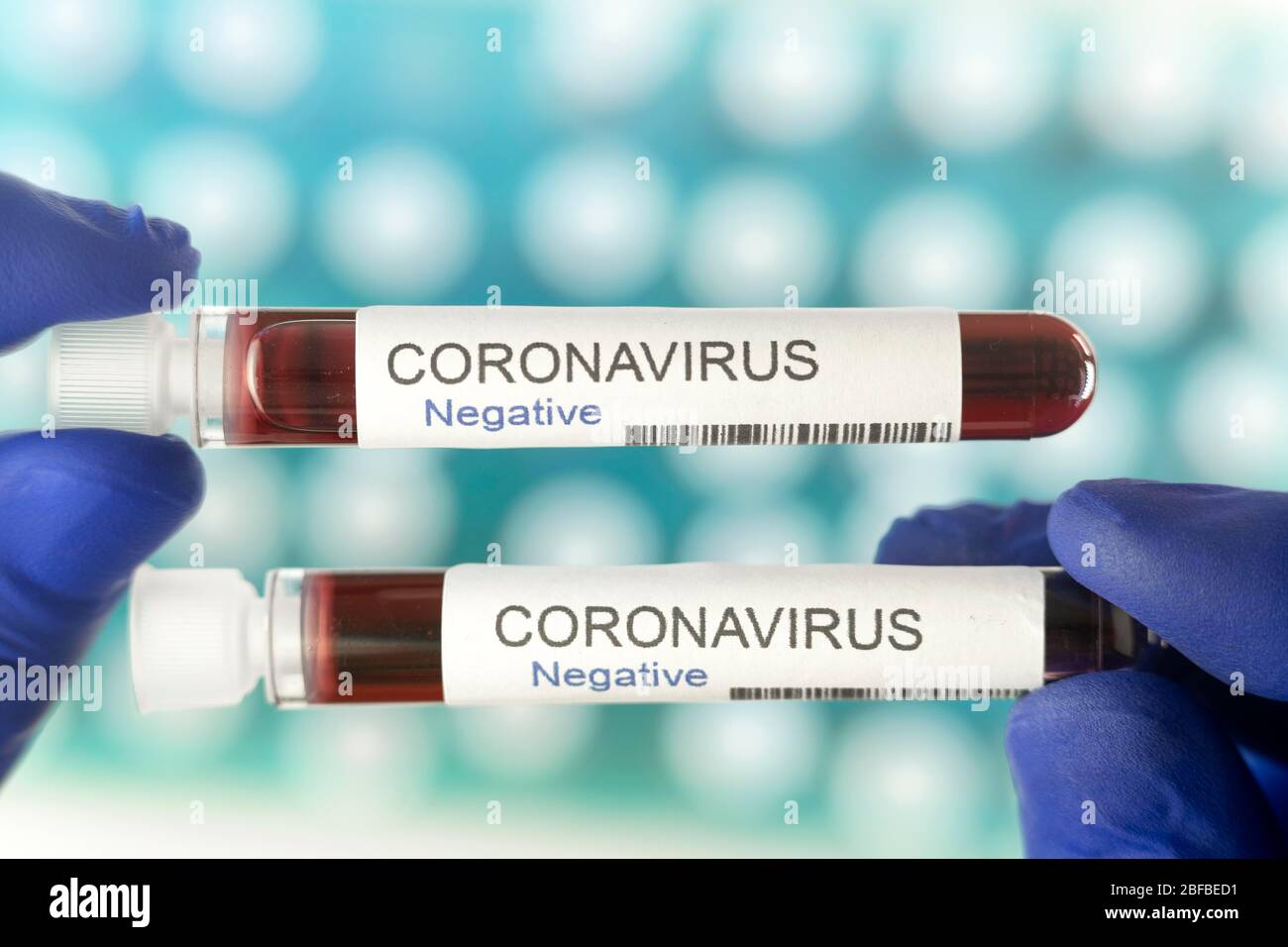 Résultat négatif de deux tests de coronavirus, symbole de la fin de la pandémie, Corona pandémique, Allemagne Banque D'Images