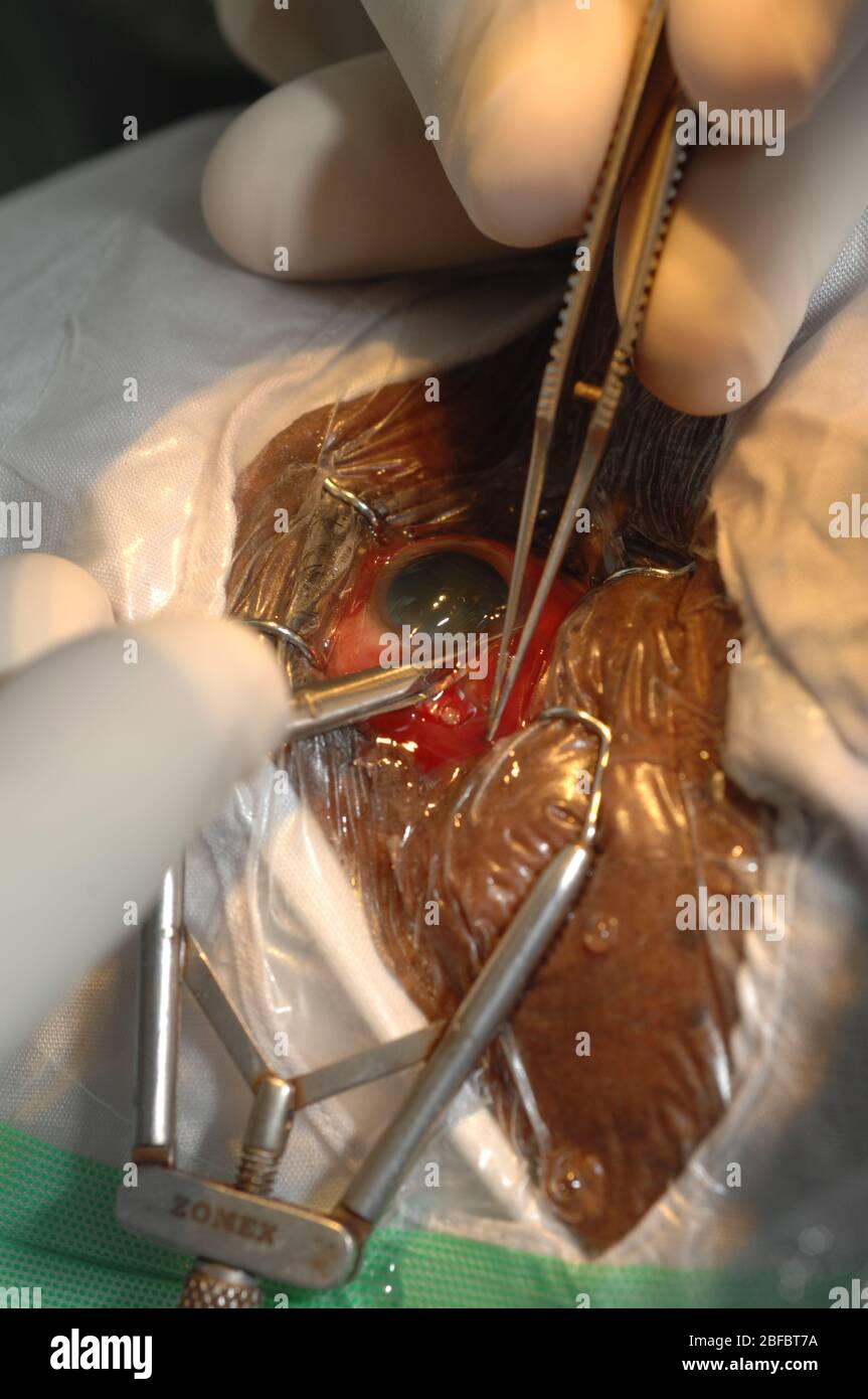 Le chirurgien utilise des ciseaux pour faire son incision initiale dans la conjonctive. Il est fait au-dessus des pars plana, où la sclérera et l'iris se rencontrent. Il est t Banque D'Images