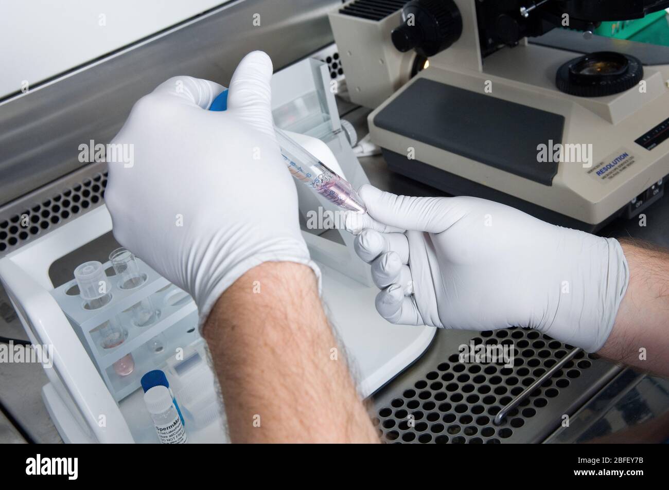 Avant la fécondation, le sperme est « lavé » dans une culture pour éliminer les liquides organiques restants de l'échantillon. (Medicamage)(modèle libéré) Banque D'Images