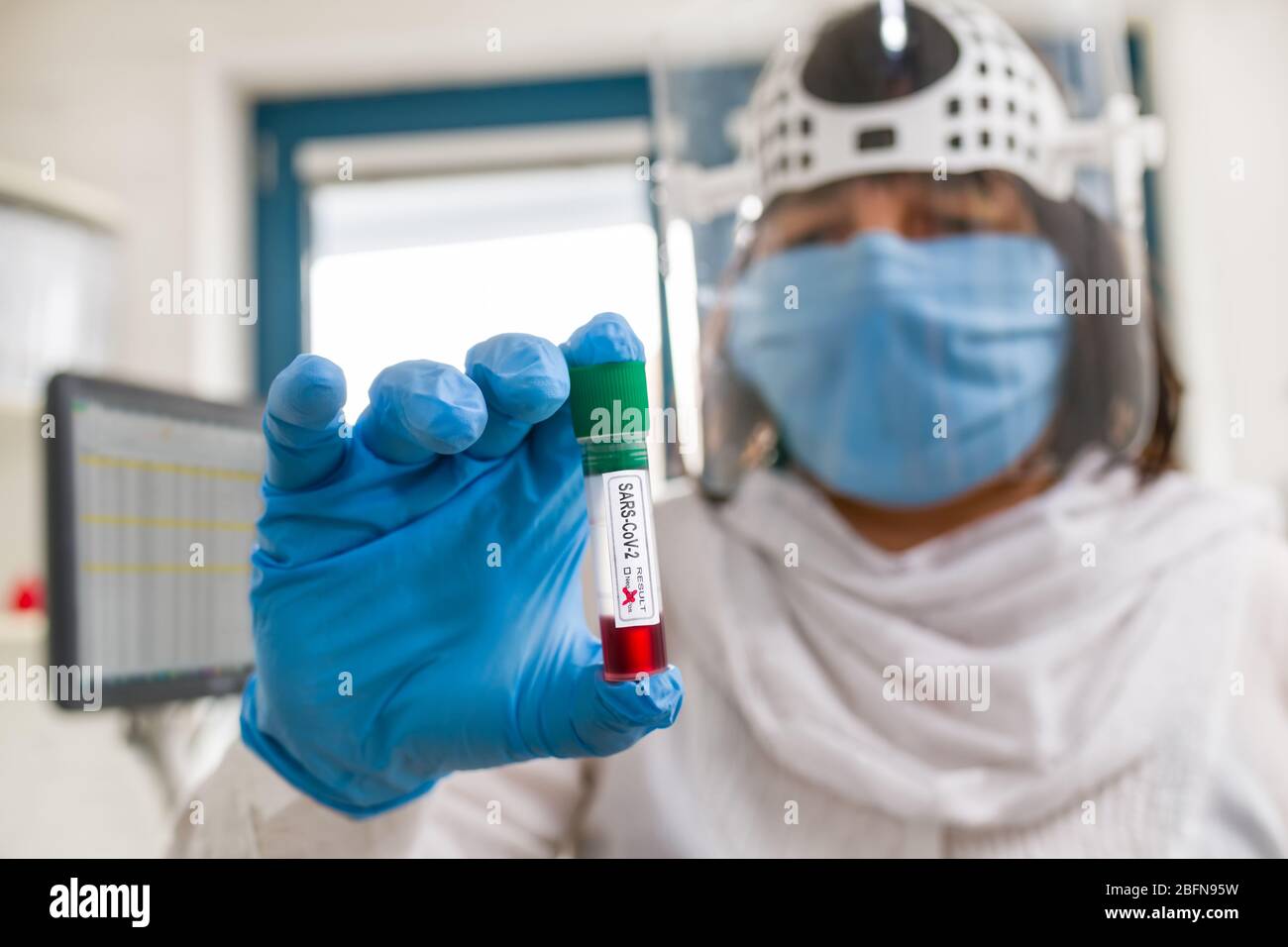 Éclosion de COVID-19. Spécialiste de laboratoire en masque et bouclier de protection. Tube d'essai à résultat positif SRAS-CoV-2 en main dans un gant bleu. Soins de santé. Banque D'Images