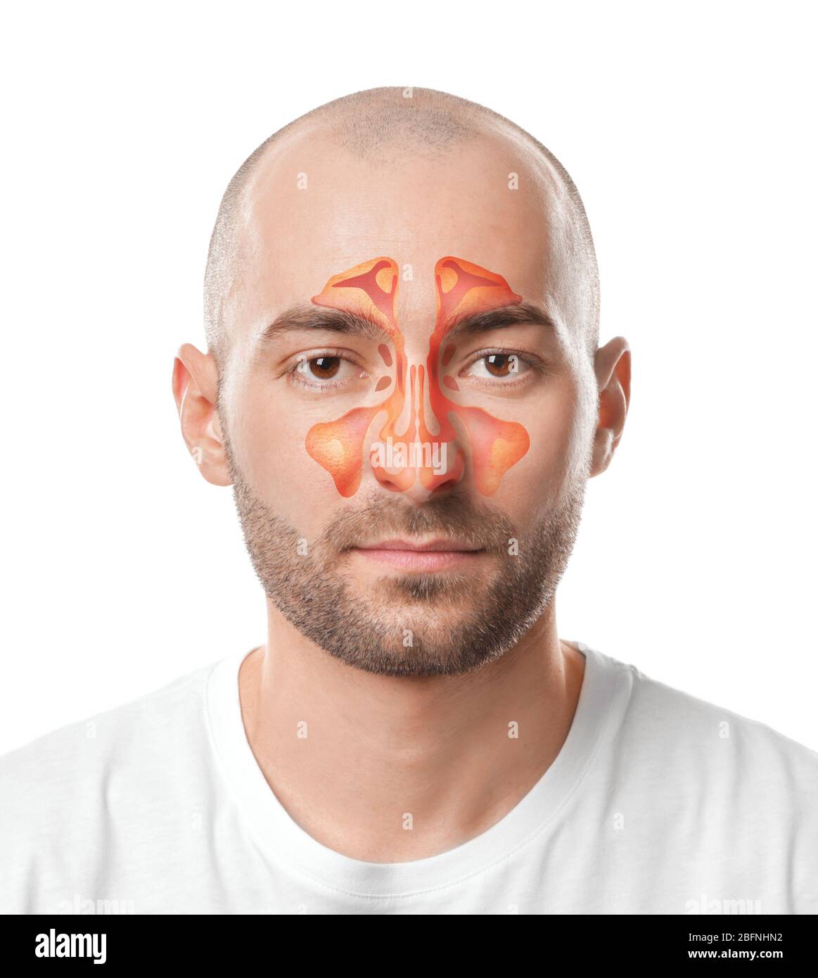 Homme avec illustration du sinus paranasal sur fond blanc. Concept d'asthme Banque D'Images