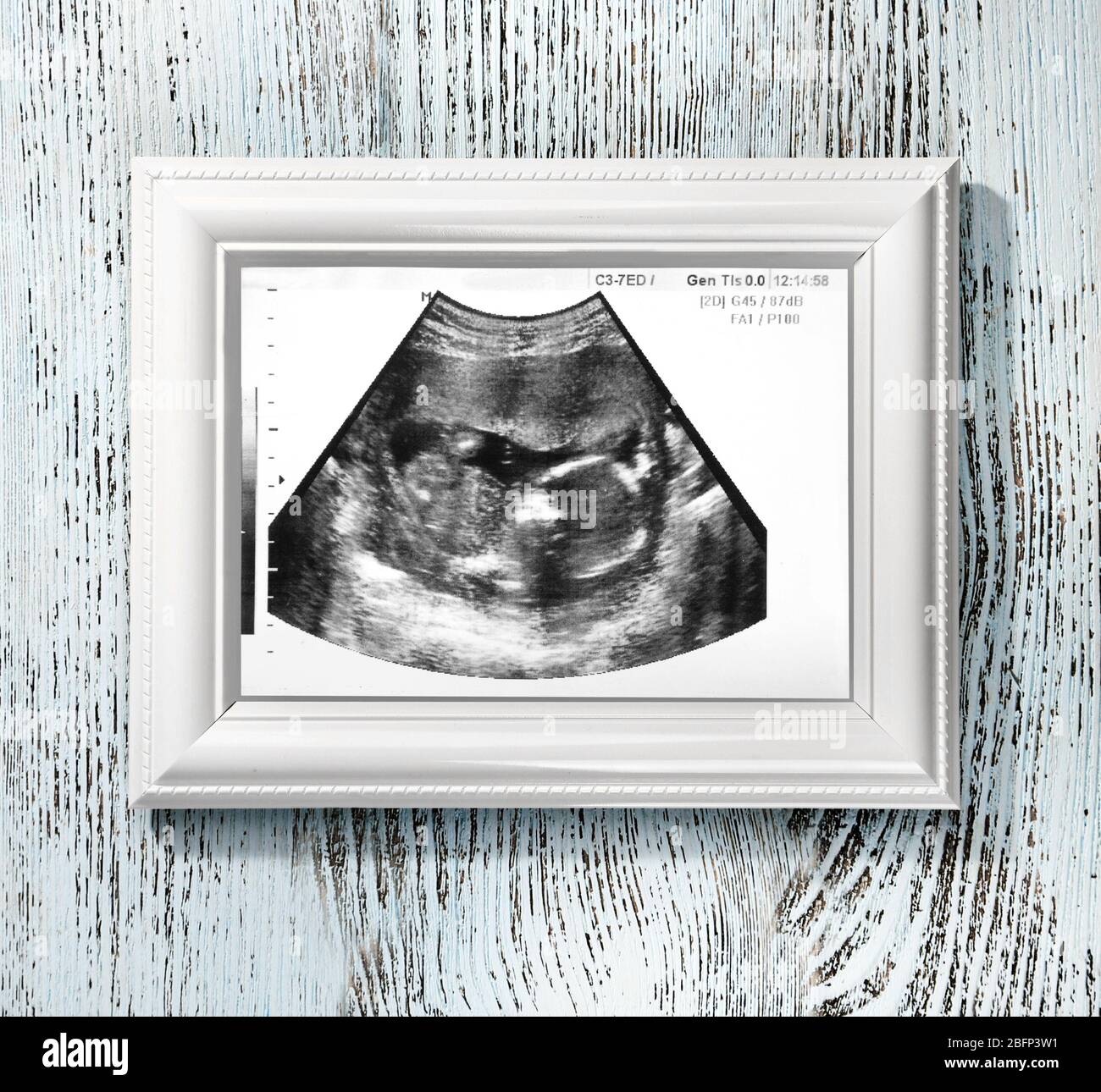 Cadre photo avec échographie de bébé sur fond en bois couleur