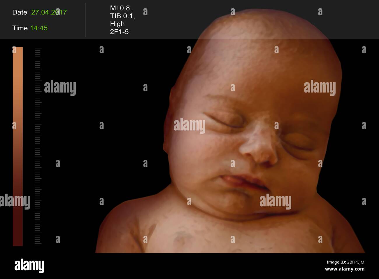 Echographie 3d Banque D Image Et Photos Alamy