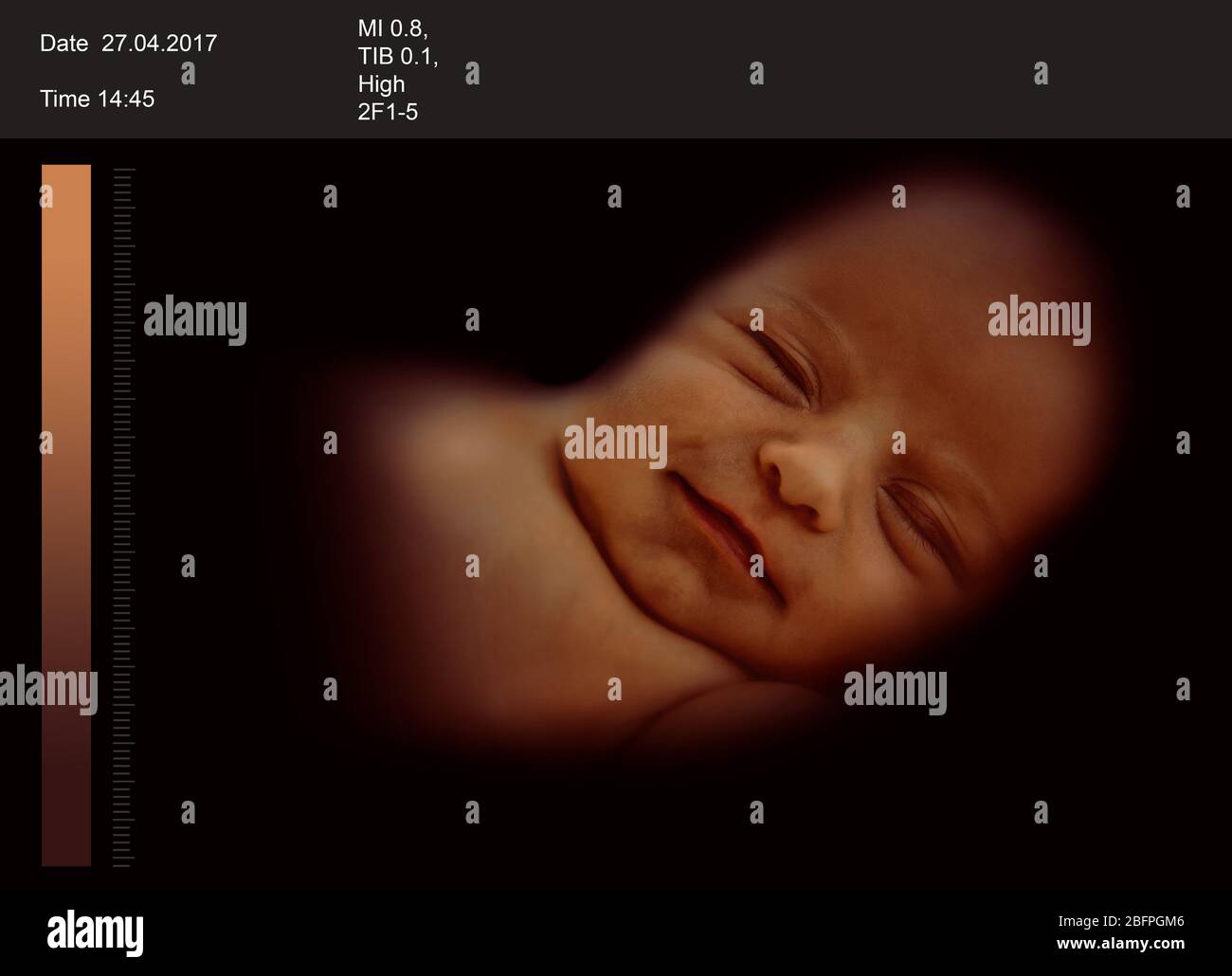 Baby Scan 3d Banque D Image Et Photos Alamy
