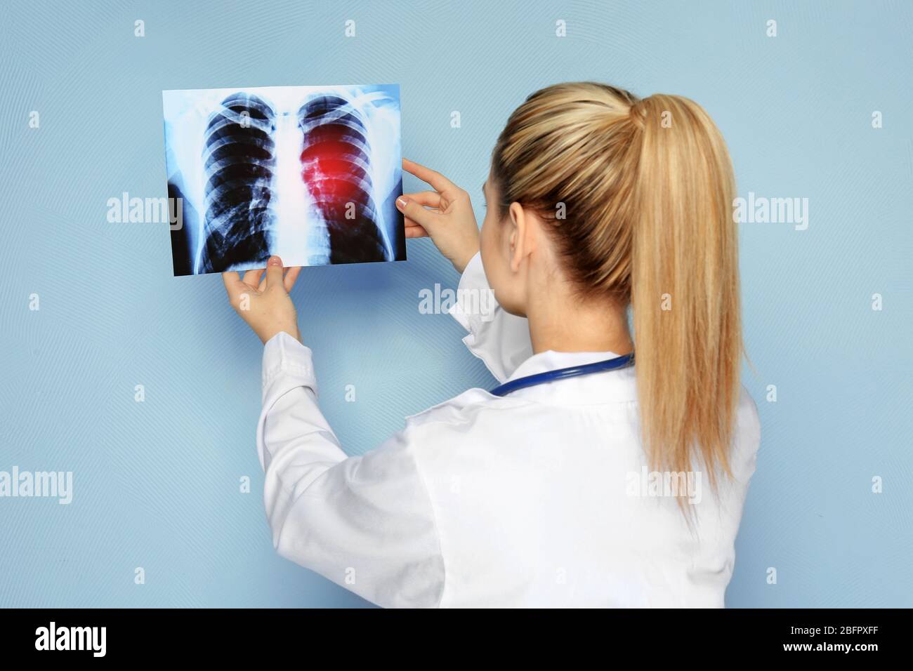 Médecin avec image radiographique sur fond couleur. Concept de cancer du poumon Banque D'Images