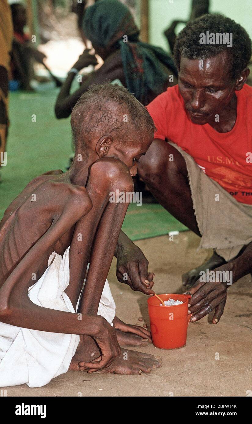 1993 - un enfant réfugié somalien est alimenté à un poste de secours mis en place lors de l'Opération Restore Hope les efforts de secours. Bardera (Somalie) Banque D'Images