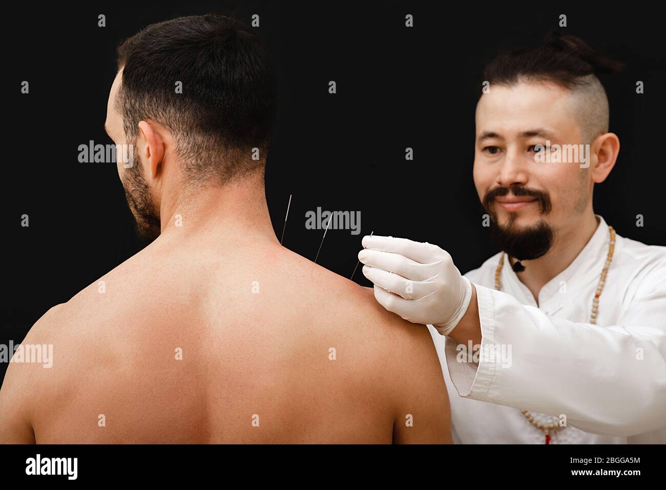 Main réflexologue avec aiguille acupuncture près de l'épaule homme. Traitement du corps d'un homme avec des méthodes de médecine chinoise. Aiguilles sur un dos noir Banque D'Images