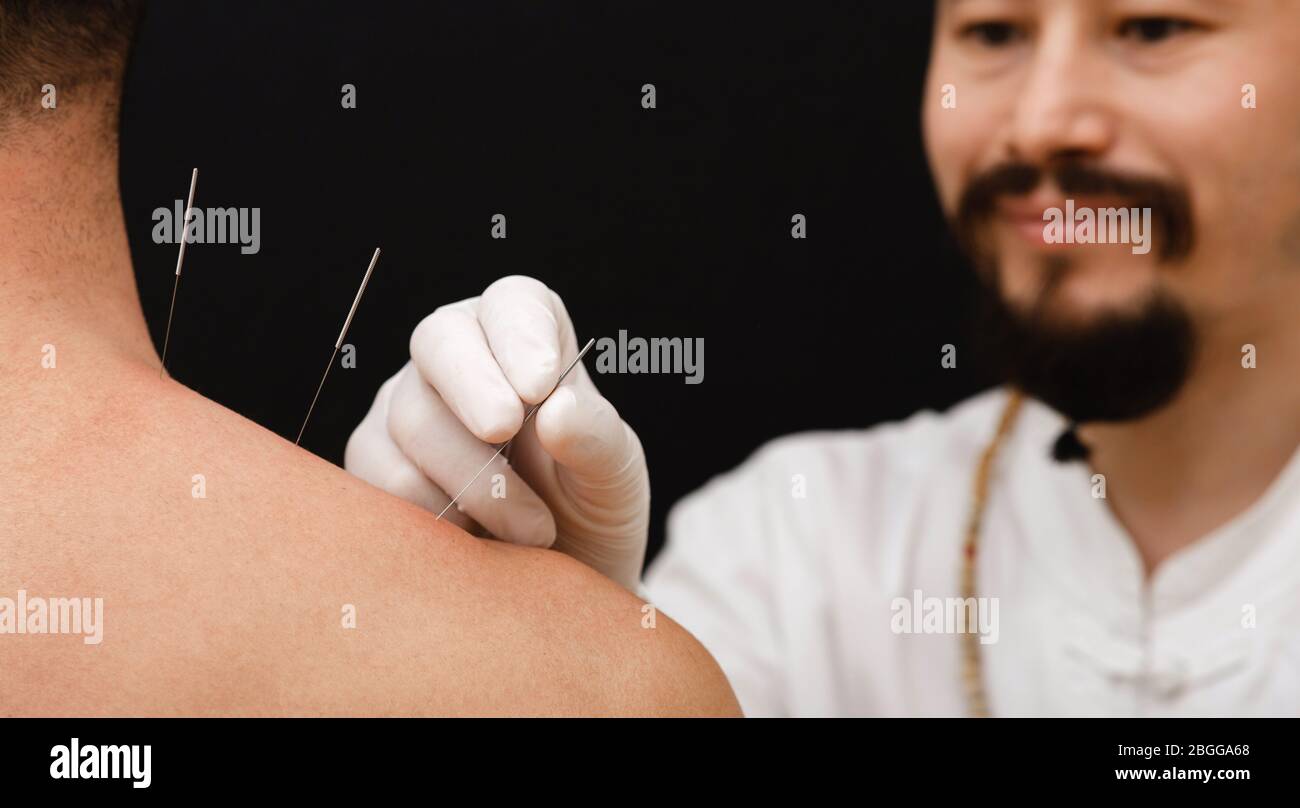 Acupuncturiste asiatique faisant de l'acupuncture pour soulager la douleur de l'épaule de l'homme. Médecine chinoise traditionnelle. Aiguilles d'acupuncture gros plan Banque D'Images