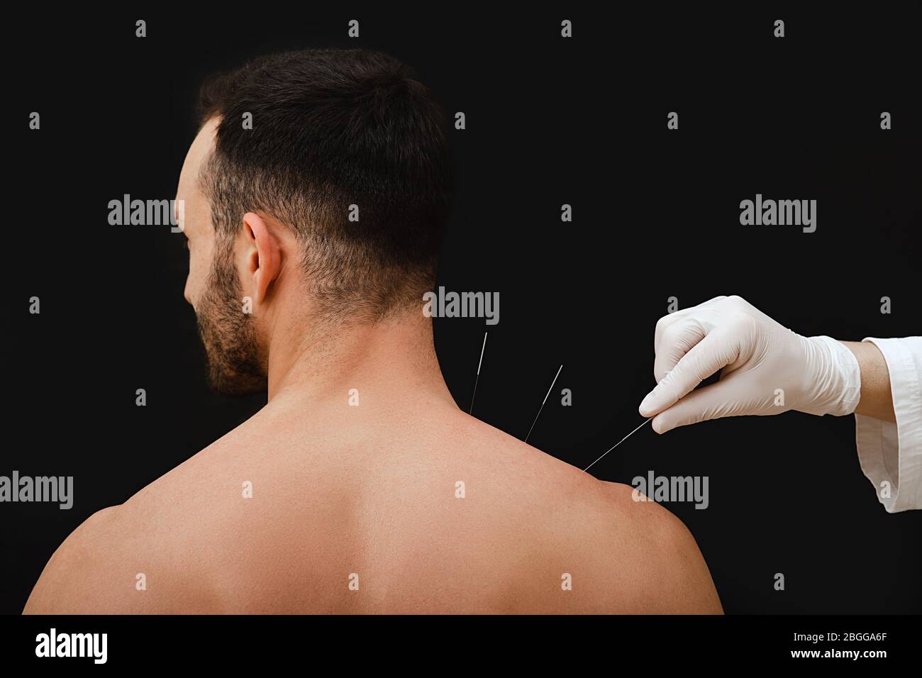 Main réflexologue avec aiguille d'acupuncture près de l'épaule d'une race caucasienne masculine. Traitement du corps d'un homme avec des méthodes de médecine chinoise. Aiguille Banque D'Images