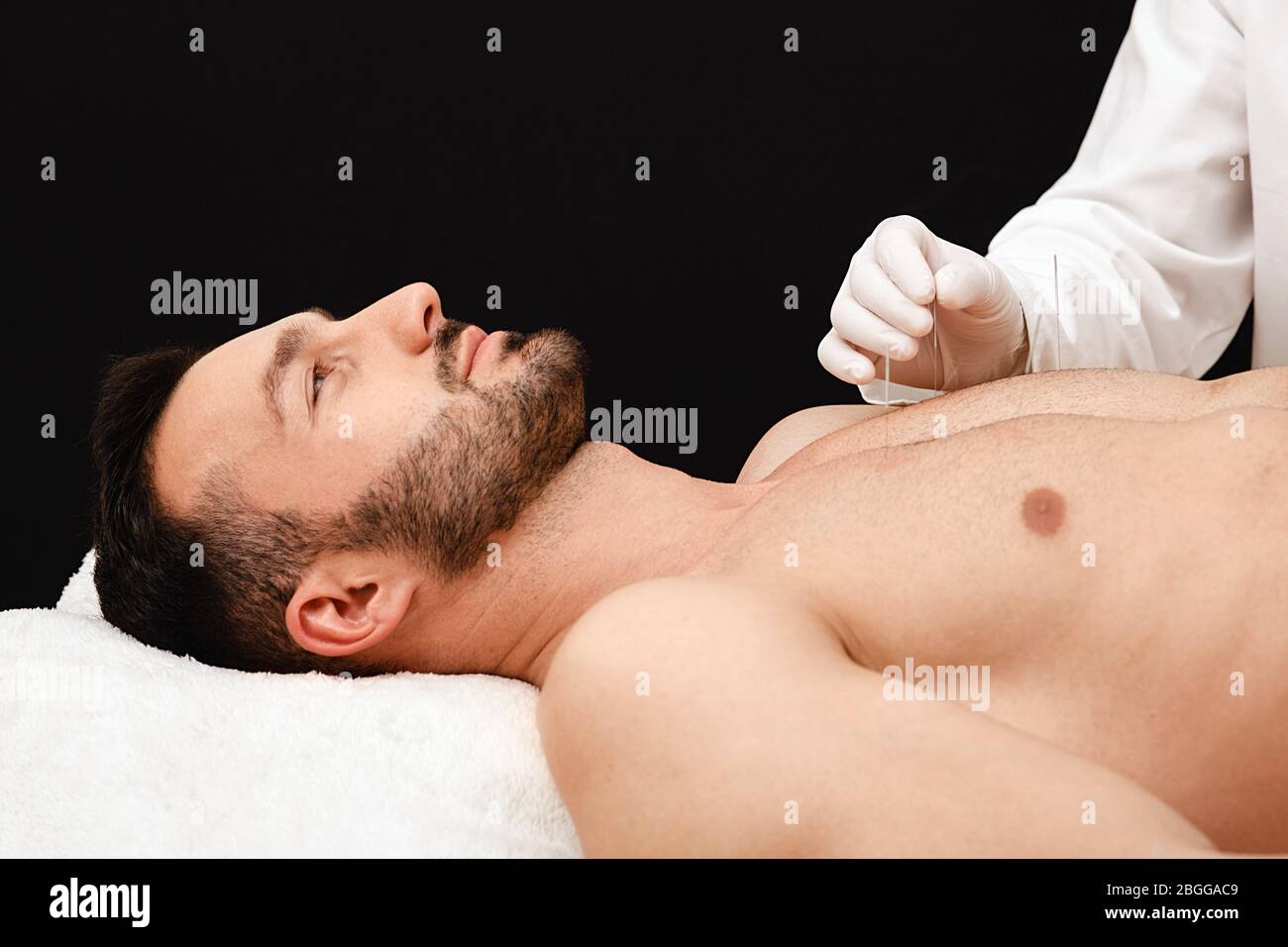 Acupuncturist insère des aiguilles d'acupuncture à des points spéciaux sur les méridiens du corps d'un homme. Aiguilles d'acupuncture dans la main réflexologue gros plan sur bl Banque D'Images