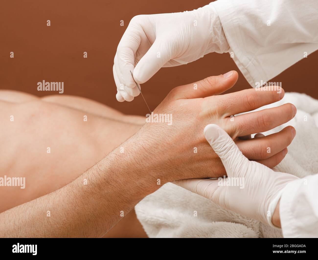 Le réflexologue insère une aiguille d'acupuncture dans la main d'un patient. Traitement d'acupuncture pour de nombreuses maladies. Gros plan Banque D'Images