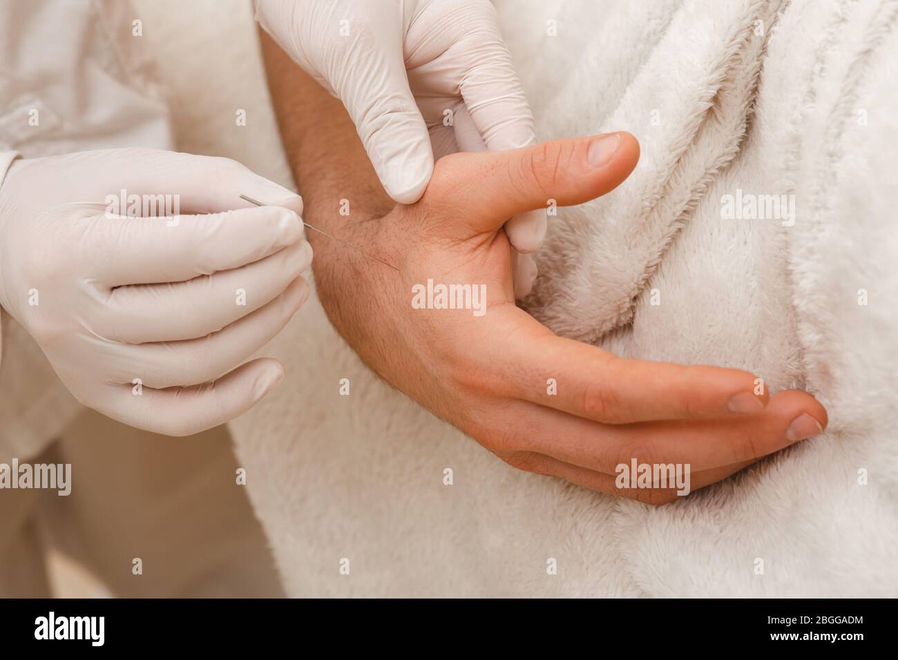 Le réflexologue insère une aiguille d'acupuncture dans la main d'un patient. Traitement d'acupuncture pour de nombreuses maladies. Gros plan Banque D'Images