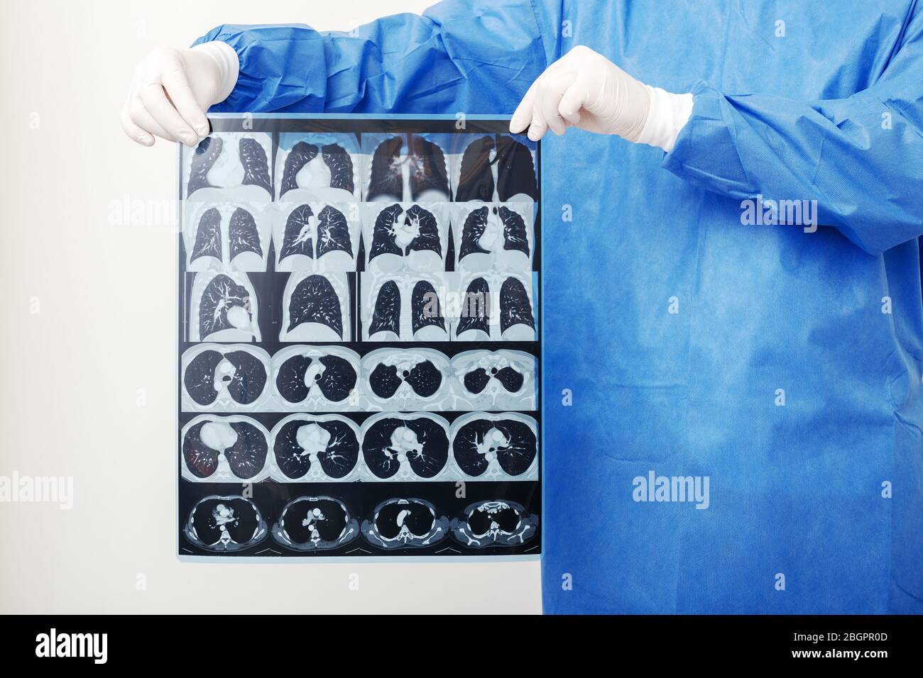 Les poumons sont numérisés dans les mains du médecin. Chirurgien en uniforme de protection, vérifiez le film IRM. Coronavirus Covid 19, pneumonie, tuberculose, cancer du poumon, respiratoire Banque D'Images