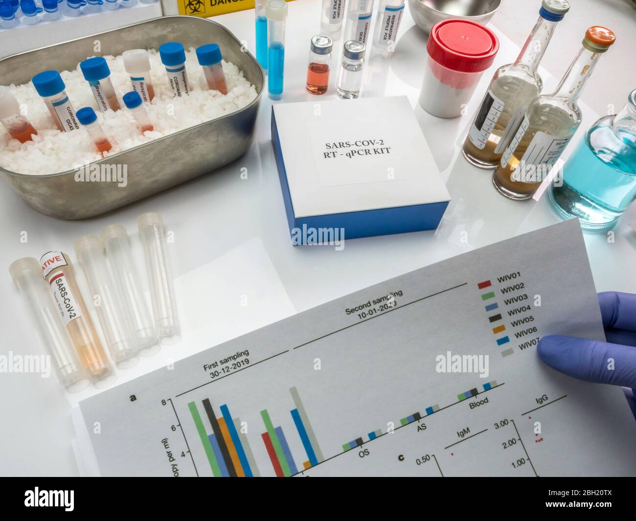 Scientifique travaillant sur l'ADN d'une femme infectée par le SRAS-Cov-2 dans un laboratoire, image conceptuelle Banque D'Images