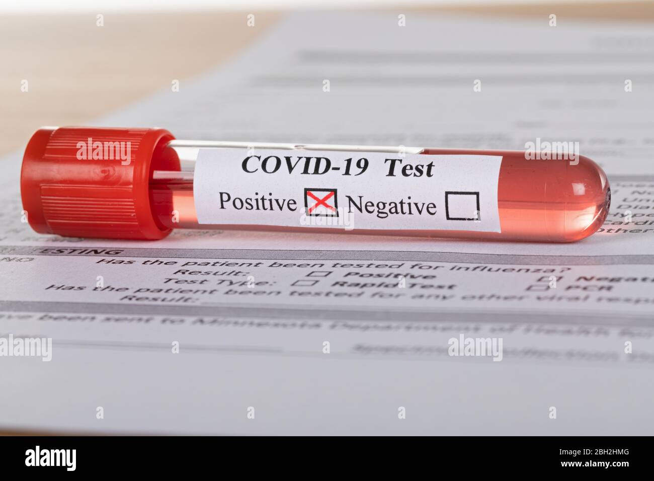 Gros plan sur l'image du test sanguin covid-19 et remplissez le formulaire Banque D'Images