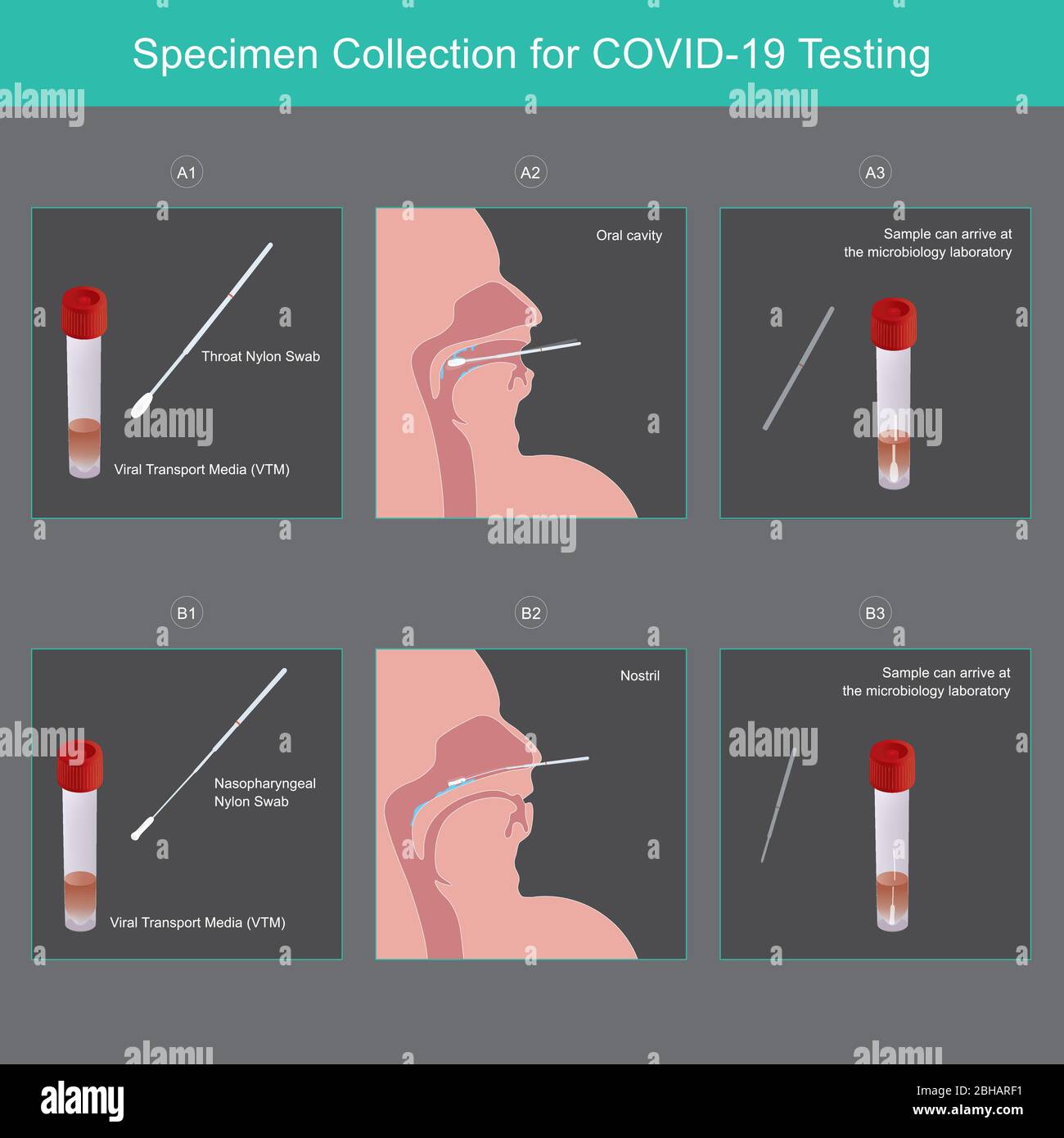 Prélèvement d'échantillons pour les tests COVID-19. Méthode utilisée milieu de transport viral (VTM) pour la collecte des sécrétions d'échantillons pour les personnes à risque virus COVID-19. Illustration de Vecteur