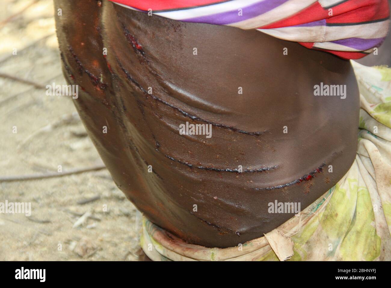Les cicatrices brutes sur le dos d'une femme Hamar après avoir été fouettées lors d'une cérémonie de "saut du taureau". Photographié dans la vallée de la rivière Omo, en Ethiopie Banque D'Images