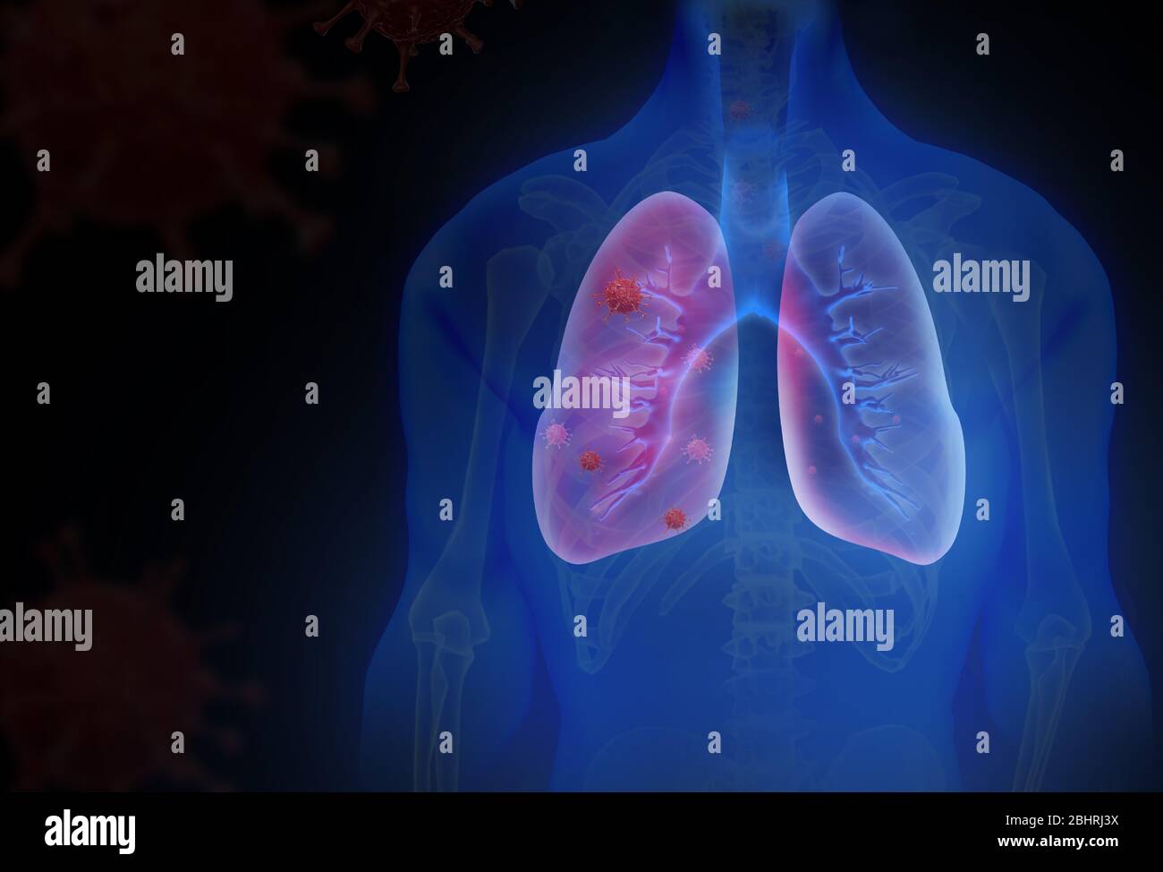 coronavirus la grippe comme cas dangereux de grippe comme une pandémie. Gros plan du virus du microscope. rendu 3d. Banque D'Images