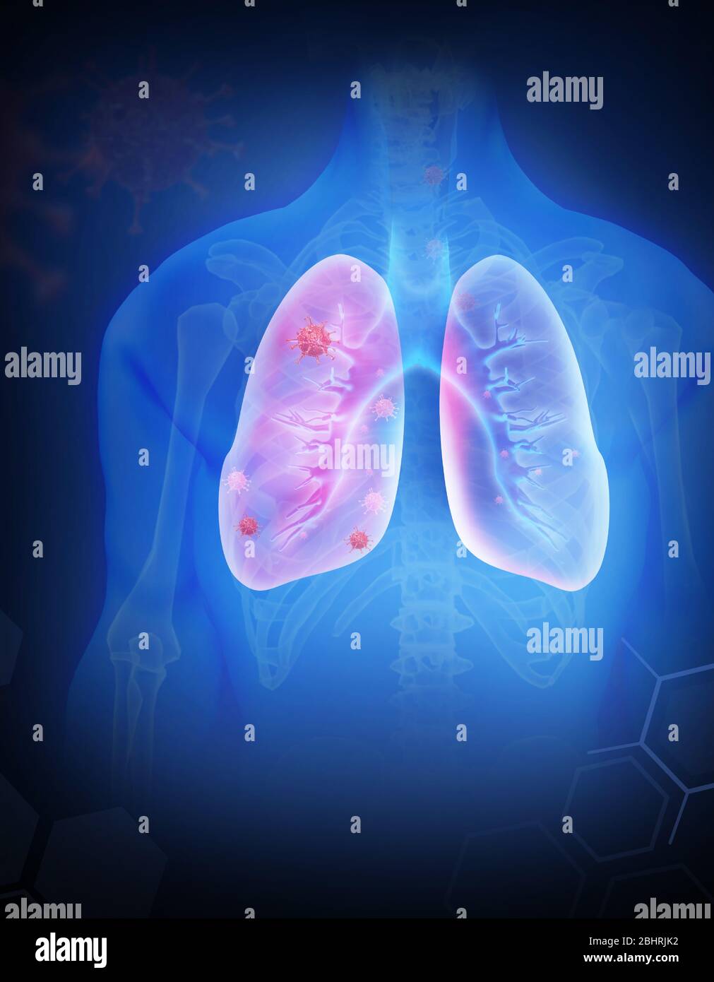 coronavirus la grippe comme cas dangereux de grippe comme une pandémie. Gros plan du virus du microscope. rendu 3d. Banque D'Images