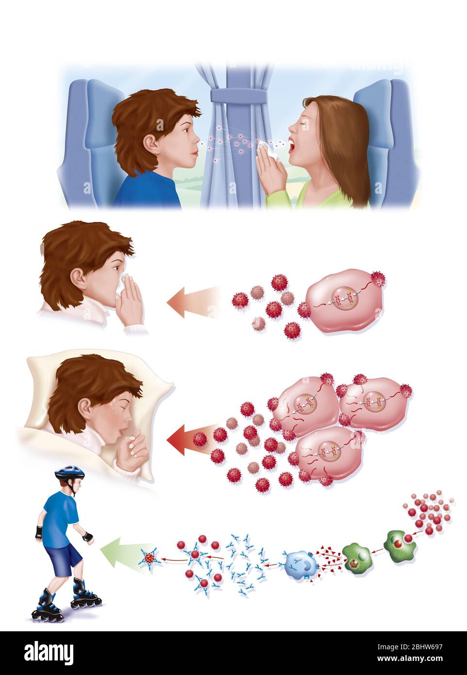 Réplication du virus froid jusqu'à la guérison. L'histoire commence par un enfant malade qui tousse et infecte le garçon devant elle. Le virus dans le garçon Banque D'Images