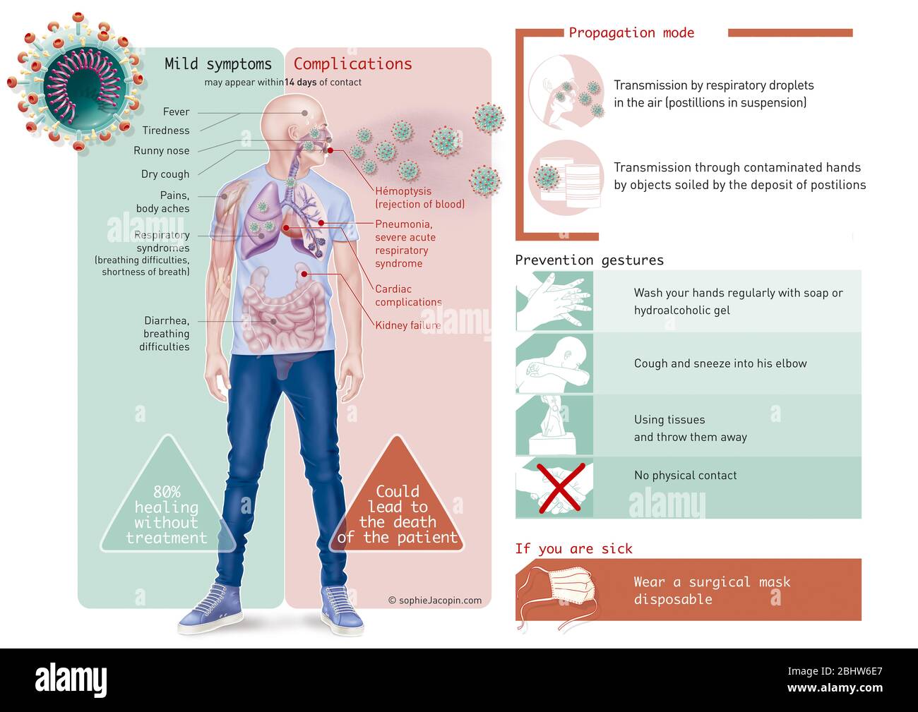 Coronavirus-symptômes-prévention, CoVid-19, SRAS-COV-2, pandémie 2020. CoVid-19 a commencé une pandémie en 2020. Le virus responsable de cette maladie de TH Banque D'Images