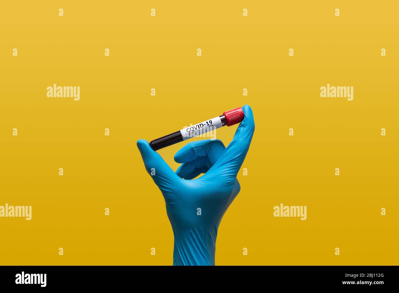 Main dans le gant bleu en caoutchouc tenant l'échantillon de sang de Coronavirus dans le tube à essai pour analyse covid-19 avec des résultats négatifs. Analyse de laboratoire pour l'essai Banque D'Images