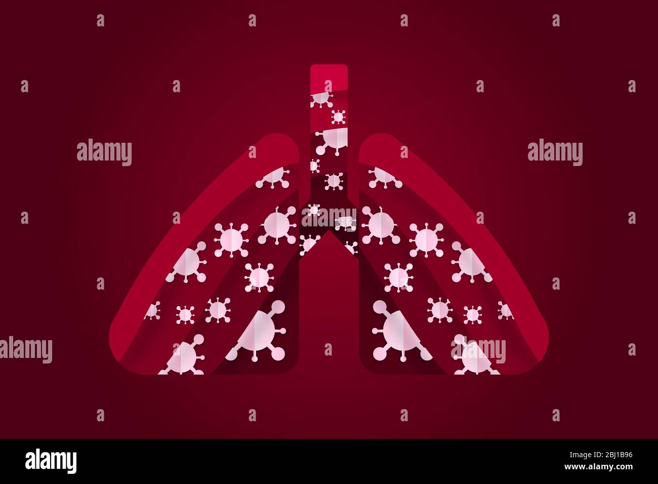 Le poumon est infecté par le coronavirus. Concept covid-19 avec infection virale grave du système respiratoire. Illustration de Vecteur