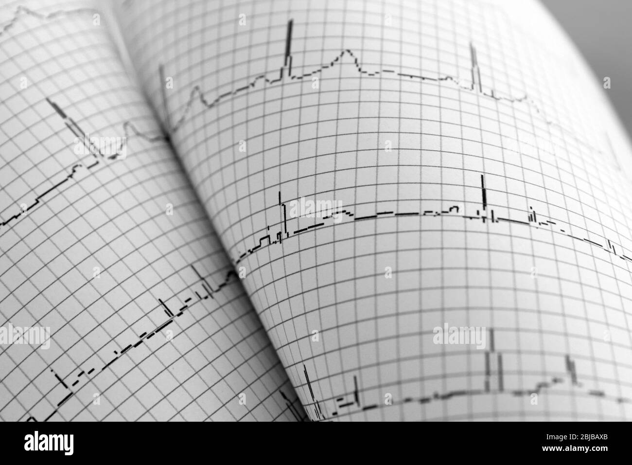 Électrocardiogramme sous forme de papier, closeup Banque D'Images