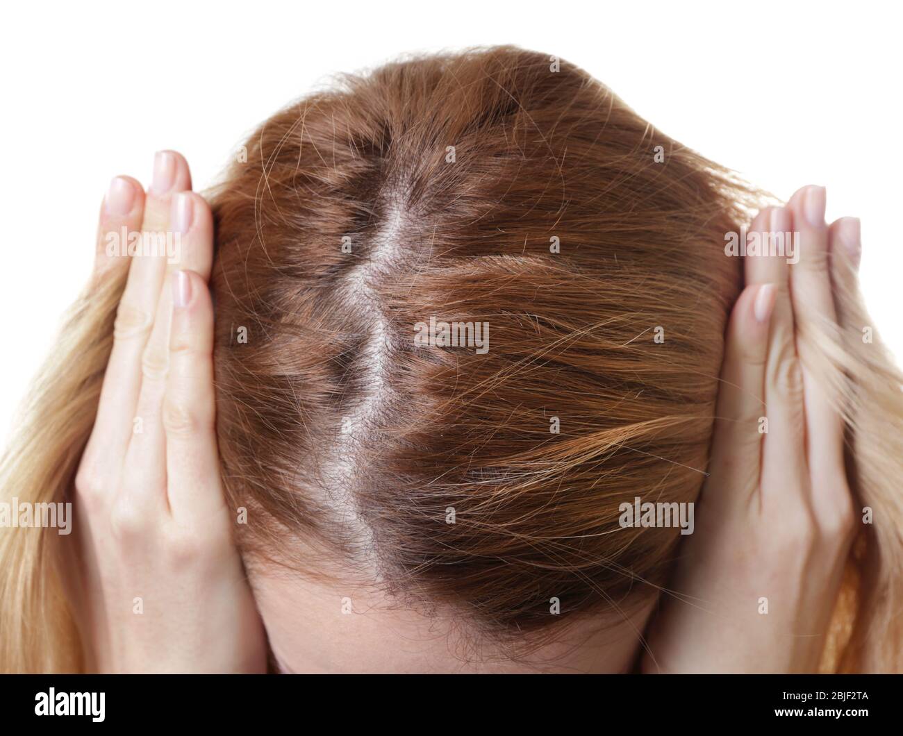 Jeune femme avec problème de perte de cheveux sur fond blanc, closeup Photo  Stock - Alamy