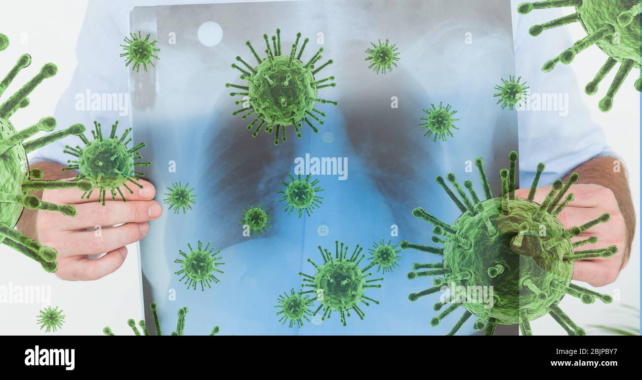 Illustration numérique d'une personne qui tient une radiographie de ses poumons sur macro Coronavirus Covid-19 c Banque D'Images